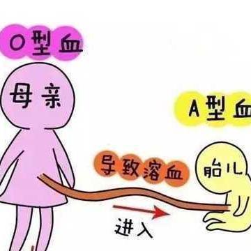 ABO溶血長大后有什么影響嗎