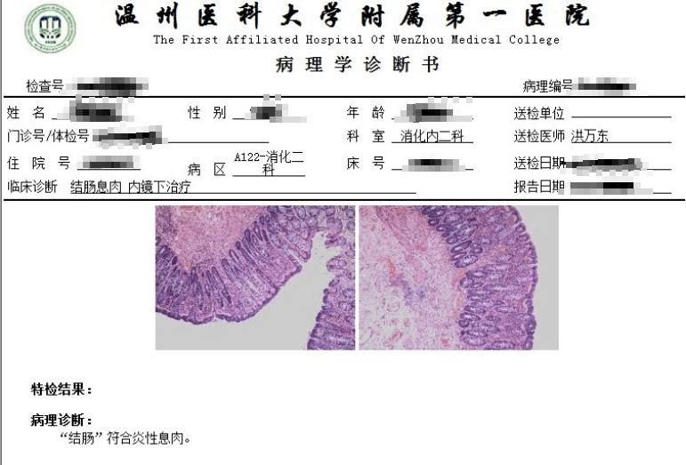 慢性附件炎會癌變嗎,關(guān)于慢性附件炎與癌變風(fēng)險及高速響應(yīng)方案解析的文章,理論研究解析說明_珂羅版44.46.33